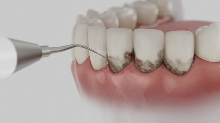 Trusted Teeth Whitening service in Houston, MS - Dentist Open Now